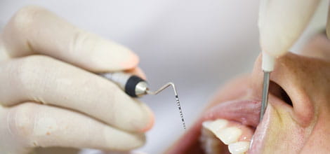 Periodontal examination